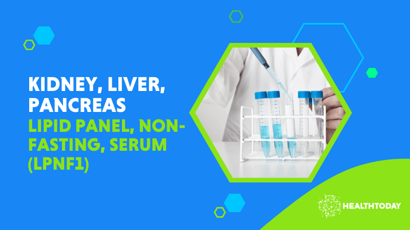 Lipid Panel, Non-Fasting, Serum (LPNF1)