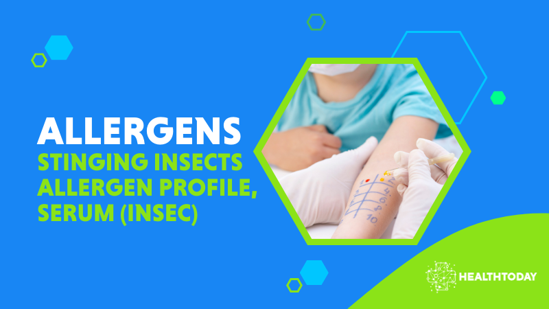 Stinging Insects Allergen Profile, Serum (INSEC)