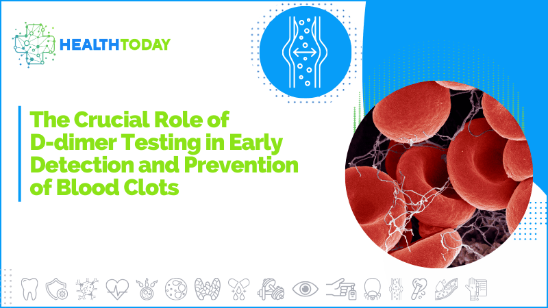 The Crucial Role of D-dimer Testing in Early Detection and Prevention of Blood Clots