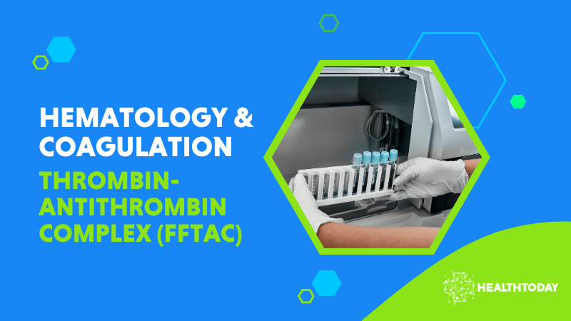 Thrombin-Antithrombin Complex (FFTAC)