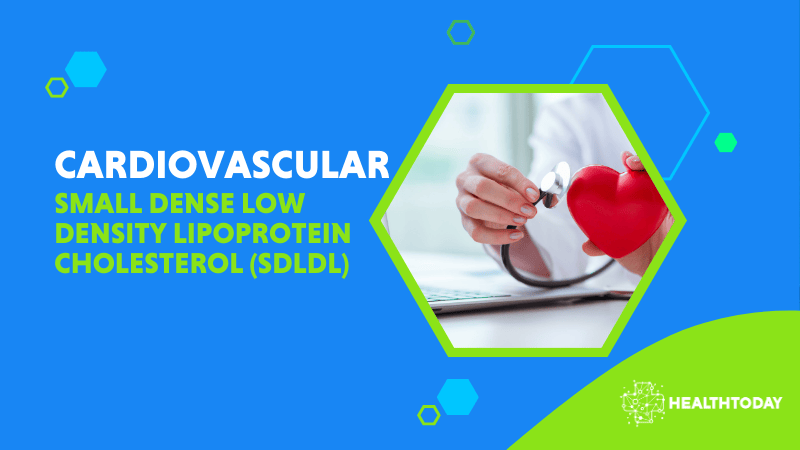 Small Dense Low Density Lipoprotein Cholesterol (SDLDL)