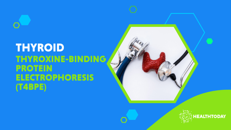 Thyroxine-Binding Protein Electrophoresis (T4BPE)