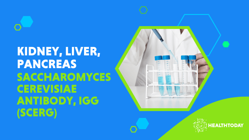 Saccharomyces cerevisiae Antibody, IgG (SCERG)