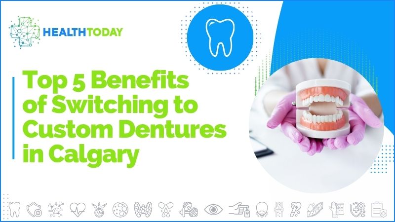 Top 5 Benefits of Switching to Custom Dentures in Calgary